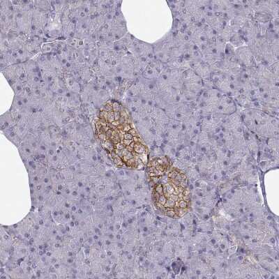 Immunohistochemistry-Paraffin: Calcium-sensing R/CaSR Antibody [NBP1-84687]