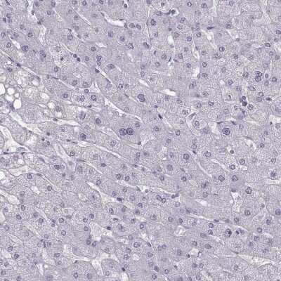 Immunohistochemistry-Paraffin: Calcium-sensing R/CaSR Antibody [NBP1-84687]