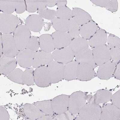 Immunohistochemistry-Paraffin: Calcium-sensing R/CaSR Antibody [NBP1-84687]
