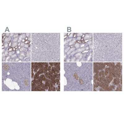 Immunohistochemistry-Paraffin: Calcium-sensing R/CaSR Antibody [NBP2-38622]