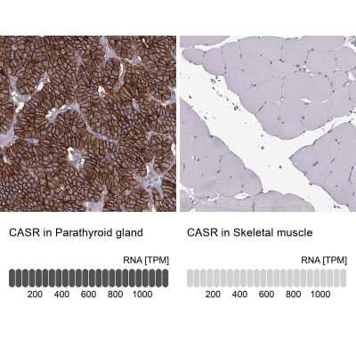 Immunohistochemistry-Paraffin: Calcium-sensing R/CaSR Antibody [NBP2-38622]