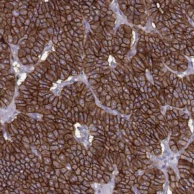 Immunohistochemistry-Paraffin: Calcium-sensing R/CaSR Antibody [NBP2-38622]