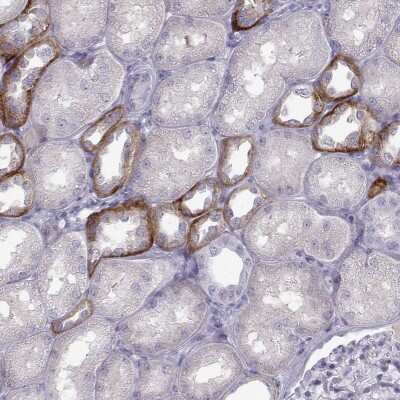 Immunohistochemistry-Paraffin: Calcium-sensing R/CaSR Antibody [NBP2-38622]