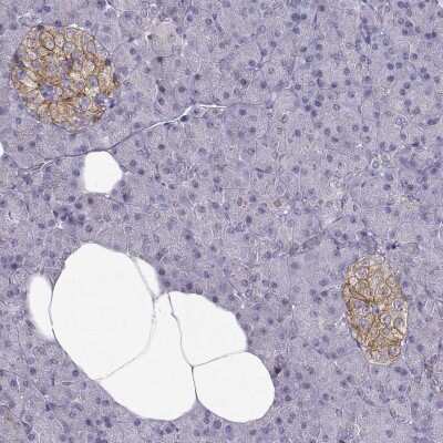 Immunohistochemistry-Paraffin: Calcium-sensing R/CaSR Antibody [NBP2-38622]