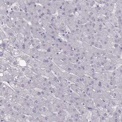 Immunohistochemistry-Paraffin: Calcium-sensing R/CaSR Antibody [NBP2-38622]