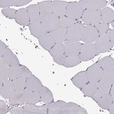 Immunohistochemistry-Paraffin: Calcium-sensing R/CaSR Antibody [NBP2-38622]