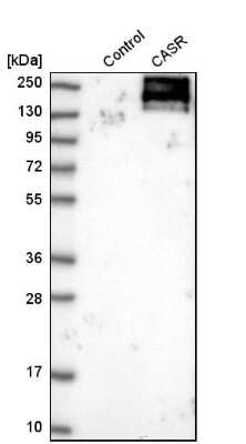 Western Blot: Calcium-sensing R/CaSR Antibody [NBP1-84687]