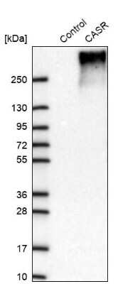 Western Blot: Calcium-sensing R/CaSR Antibody [NBP2-38622]