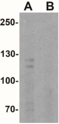 Western Blot: Calcium-sensing R/CaSR AntibodyBSA Free [NBP2-41271]