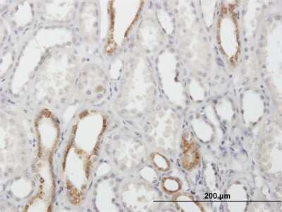 Immunohistochemistry-Paraffin: Calcyphosine Antibody [H00000828-B01P]