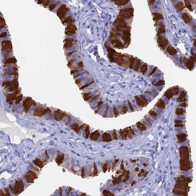 Immunohistochemistry-Paraffin: Calcyphosine Antibody [NBP1-91746]