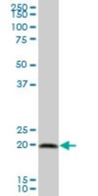 Western Blot: Calcyphosine Antibody [H00000828-B01P]