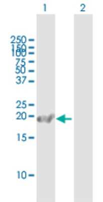 Western Blot: Calcyphosine Antibody [H00000828-B01P]