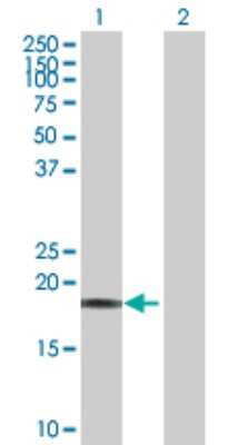 Western Blot: Calcyphosine Antibody [H00000828-D01P]