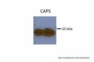 Western Blot: Calcyphosine Antibody [NBP1-58929]
