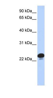 Western Blot: Calcyphosine Antibody [NBP1-58929]