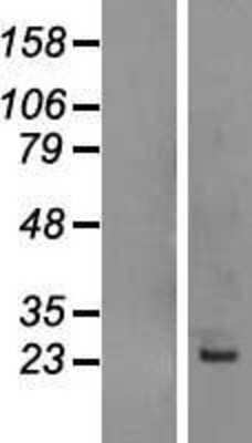 Western Blot: Calcyphosine Overexpression Lysate [NBL1-08688]