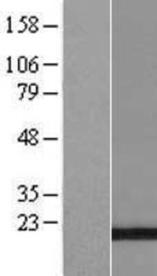 Western Blot: Calcyphosine Overexpression Lysate [NBP2-05775]