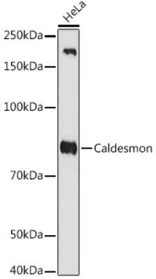 Western Blot: Caldesmon/CALD1 Antibody (6M5Q9) [NBP3-16499]