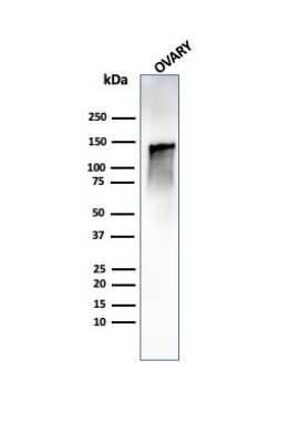 Western Blot: Caldesmon/CALD1 Antibody (CALD1/1424R)Azide and BSA Free [NBP2-54311]