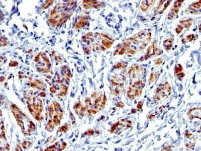 Immunohistochemistry-Paraffin: Caldesmon/CALD1 Antibody (CALD1/1424R) [NBP2-53225]