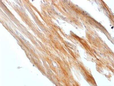 Immunohistochemistry-Paraffin: Caldesmon/CALD1 Antibody (CALD1/1424R) [NBP2-53225]