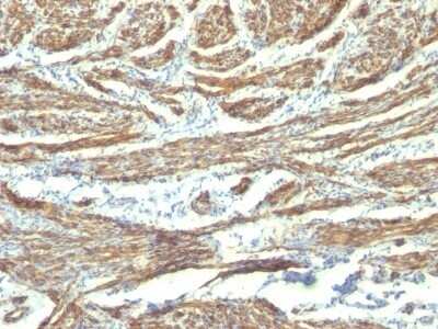 Immunohistochemistry-Paraffin: Caldesmon/CALD1 Antibody (CALD1/820 + h-CALD) - Azide and BSA Free [NBP2-47819]