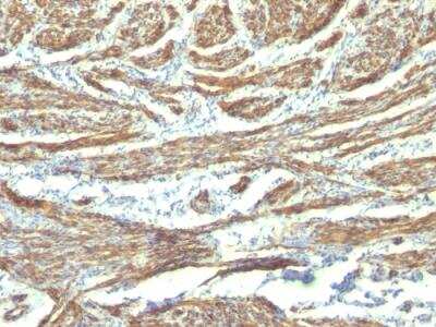 Immunohistochemistry-Paraffin: Caldesmon/CALD1 Antibody (CALD1/820 + h-CALD) - IHC-Prediluted [NBP2-48183]