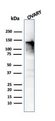 Western Blot: Caldesmon/CALD1 Antibody (CALD1/820)Azide and BSA Free [NBP2-47818]