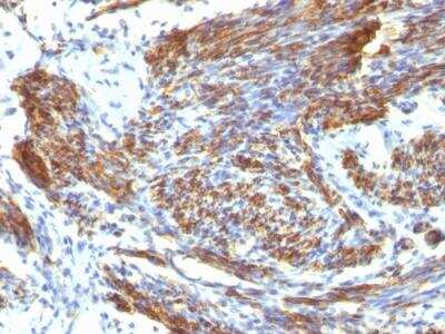 Immunohistochemistry-Paraffin: Caldesmon/CALD1 Antibody (CALD1/820) - IHC-Prediluted [NBP2-48182]