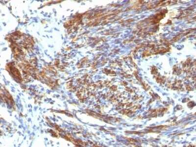 Immunohistochemistry-Paraffin: Caldesmon/CALD1 Antibody (CALD1/820) [NBP2-44423]