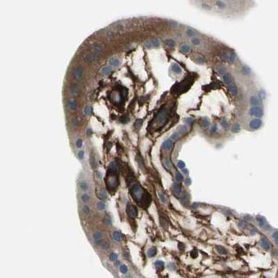 Immunohistochemistry-Paraffin: Caldesmon/CALD1 Antibody [NBP1-85702]