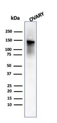 Western Blot: Caldesmon/CALD1 Antibody (SPM168)Azide and BSA Free [NBP2-47817]