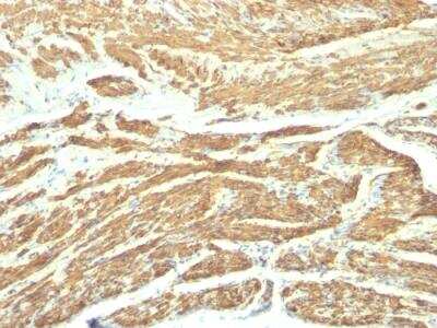 Immunohistochemistry-Paraffin: Caldesmon/CALD1 Antibody (SPM168) - IHC-Prediluted [NBP2-48181]