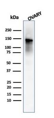 Western Blot: Caldesmon/CALD1 Antibody (SPM168) [NBP2-44422]