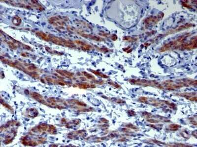Immunohistochemistry-Paraffin: Caldesmon/CALD1 Antibody (h-CALD) - Azide and BSA Free [NBP2-47816]