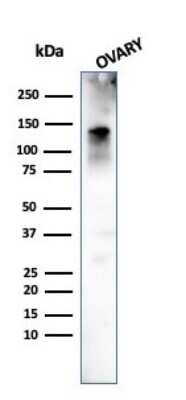 Western Blot: Caldesmon/CALD1 Antibody (h-CALD)Azide and BSA Free [NBP2-47816]