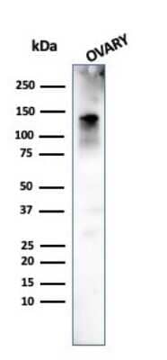 Western Blot: Caldesmon/CALD1 Antibody (h-CALD) [NBP2-44421]