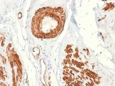 Immunohistochemistry-Paraffin: Caldesmon/CALD1 Antibody (rCALD1/820) - Azide and BSA Free [NBP3-08326]