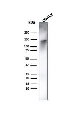 Western Blot: Caldesmon/CALD1 Antibody (rCALD1/820)Azide and BSA Free [NBP3-08326]