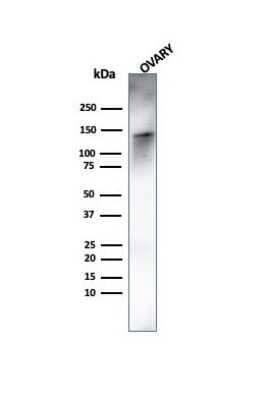 Western Blot: Caldesmon/CALD1 Antibody (rCALD1/820) [NBP3-07367]