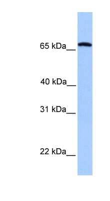 Western Blot: Calicin Antibody [NBP1-53182]