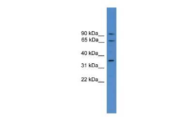 Western Blot: Calicin Antibody [NBP2-83963]