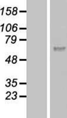 Western Blot: Calicin Overexpression Lysate [NBL1-08837]