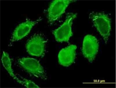 Immunocytochemistry/ Immunofluorescence: Calmodulin 2 Antibody (3F4-G5) [H00000805-M01]