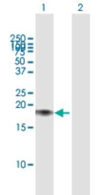 Western Blot: Calmodulin 2 Antibody [H00000805-B01P]