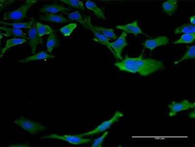 Immunocytochemistry/ Immunofluorescence: Calmodulin 3 Antibody (1E2) [H00000808-M11]