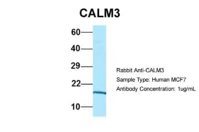 Western Blot: Calmodulin 3 Antibody [NBP1-98474]