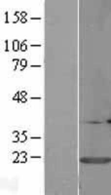 Western Blot: Calmodulin 3 Overexpression Lysate [NBL1-08651]