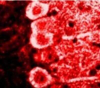 Immunocytochemistry/ Immunofluorescence: Calmodulin Antibody (2D1) - BSA Free [NB120-2860]